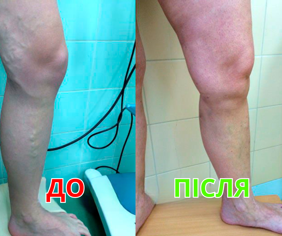 Результат до і після